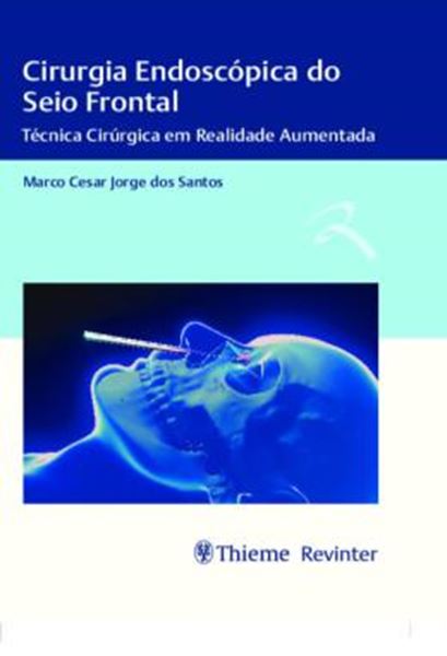 Picture of CIRURGIA ENDOSCOPICA DO SEIO FRONTAL